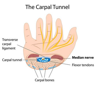 carpal-tunnel.jpg