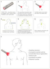 How TenDlite Works